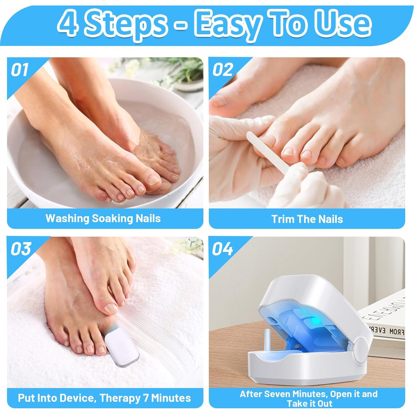 Rechargeable Nail Fungus Treatment For Toenail Toe Nail Fungal Treatment Nail Fungus Laser Device Anti-fungal Nail Treatment For Hand  Feet Infections Remover For Home Use